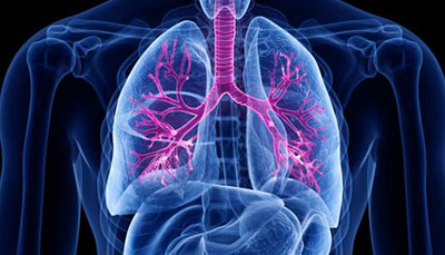 什么是慢性阻塞性肺病 (Chronic Obstructive Pulmonary Disease)，為何與新冠疫情有關(guān)？